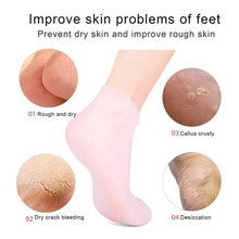 Load image into Gallery viewer, Moisturizing Anti-Crack 100% Soft Silicone Socks for heal cracks, lightweight, flexible and pain relief at Affordable price.