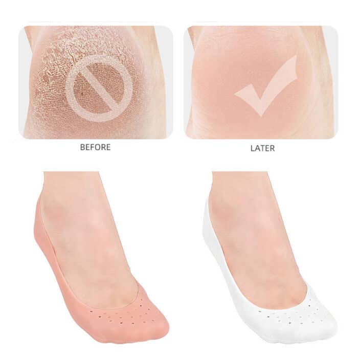 Moisturizing Anti-Crack 100% Soft Silicone Socks for heal cracks, lightweight, flexible and pain relief at Affordable price.